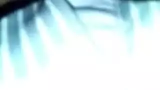 صب الشرج في أعلى الصفحة مفلس الآسيوية